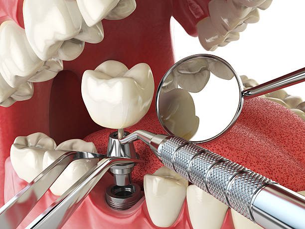 Best Emergency Dentist for Special Needs Patients in Loogootee, IN
