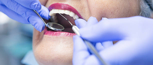 Best Emergency Dental Care for Abscessed Tooth in Loogootee, IN